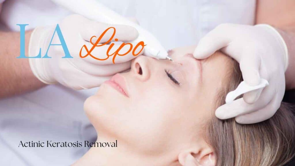 actinic keratosis removal Fareham