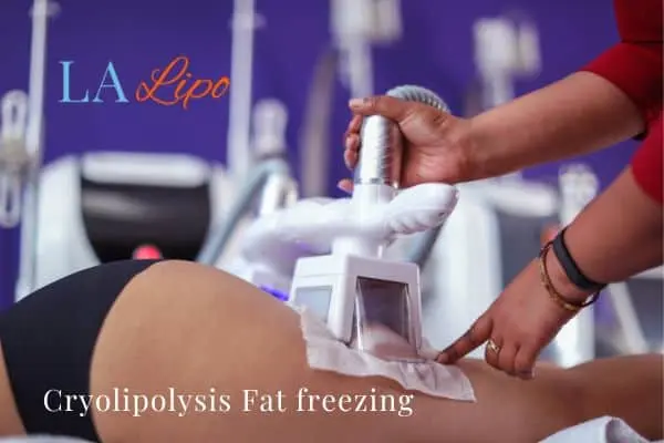 women getting fat freezing Fareham