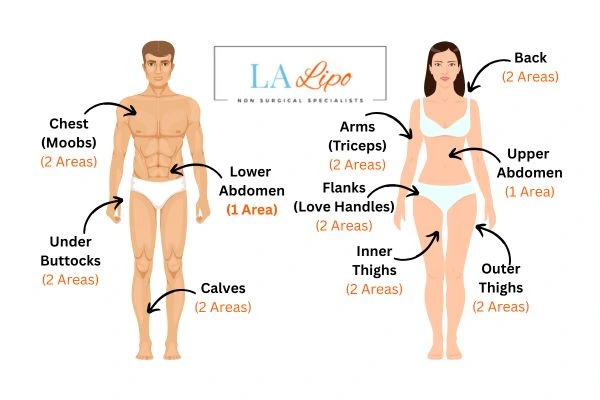 LA LIPO Cryolipolysis Areas Fareham