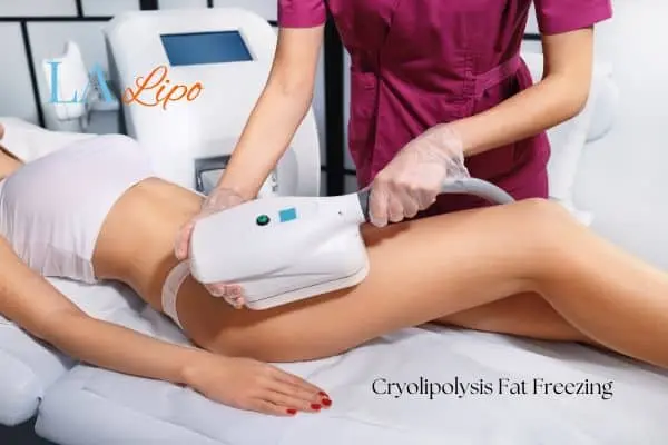 Woman receiving coolsculpting Fareham treatment on her thighs